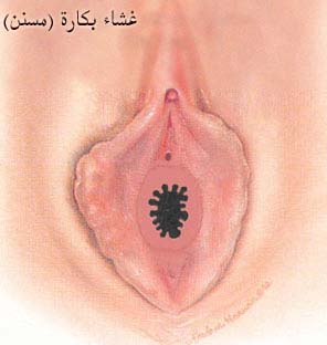 [صورة: mosanan.jpg]