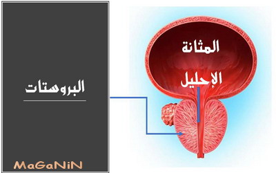 احتقان والتهاب البروستات والطب النفسي